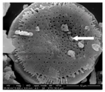 Working principle of Diatomite Filter Aid
